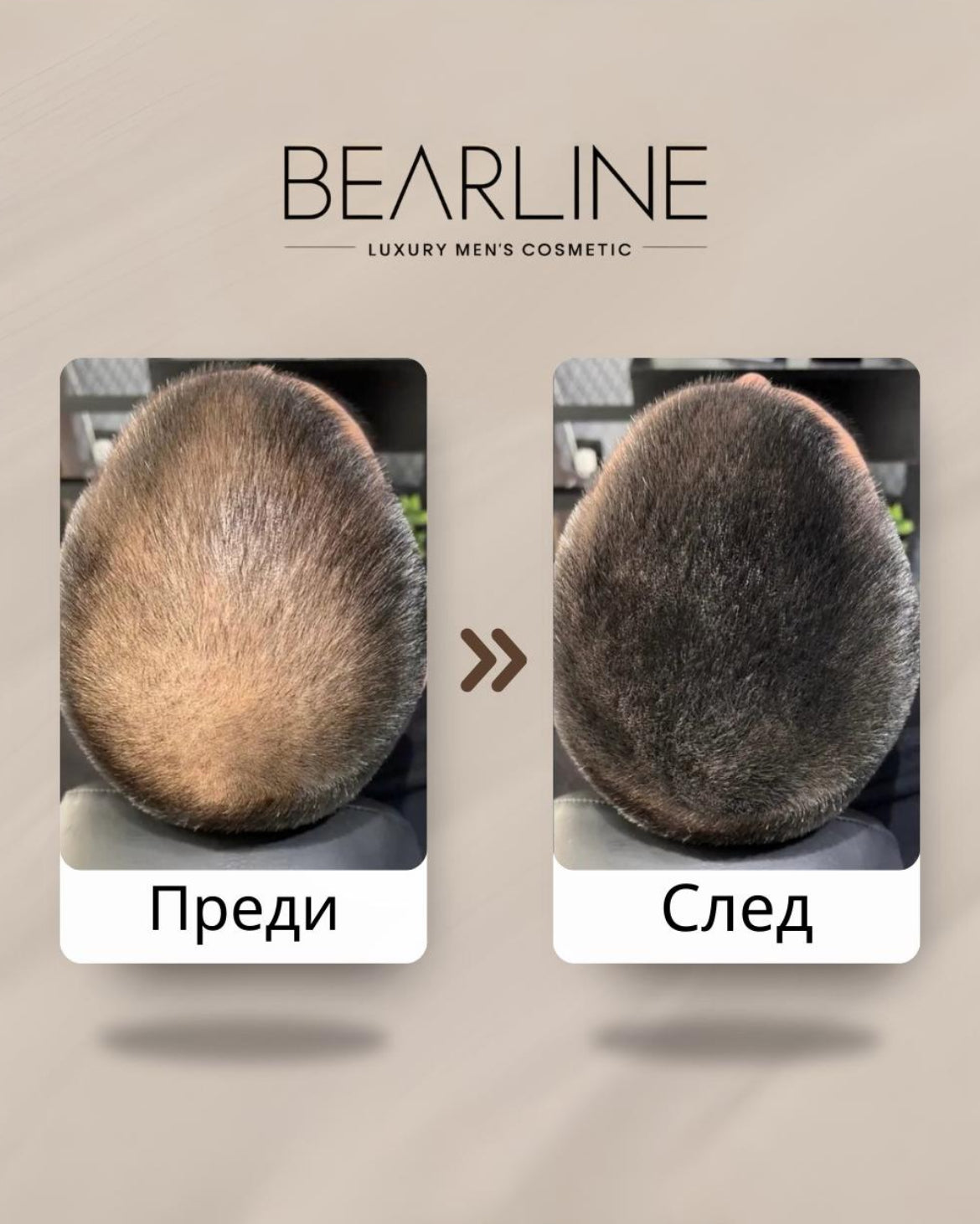 Луксозна пудра Bearline™