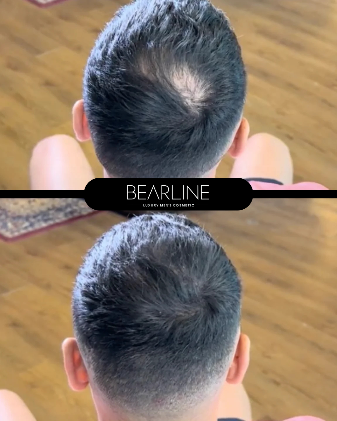 Луксозна пудра Bearline™